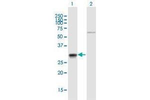 Western Blot analysis of CA7 expression in transfected 293T cell line by CA7 MaxPab polyclonal antibody. (CA7 Antikörper  (AA 1-264))