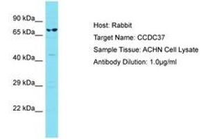 Image no. 1 for anti-Coiled-Coil Domain Containing 37 (CCDC37) (AA 528-577) antibody (ABIN6750799) (CCDC37 Antikörper  (AA 528-577))