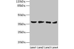 Western blot All lanes: AKR1C2 antibody at 14 μg/mL Lane 1: HepG2 whole cell lysate Lane 2: MCF-7 whole cell lysate Lane 3: Hela whole cell lysate Lane 4: Rat liver tissue Secondary Goat polyclonal to rabbit IgG at 1/10000 dilution Predicted band size: 37, 16 kDa Observed band size: 37 kDa (AKR1C2 Antikörper  (AA 1-323))