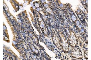 ABIN7094592 and ABIN7098641 at 1/100 staining Mouse colorectal tissue by IHC-P. (SSH1 Antikörper  (C-Term))