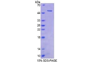 SDS-PAGE analysis of Human CBLN1 Protein. (CBLN1 Protein)