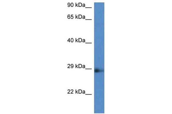 NAA11 Antikörper  (Middle Region)