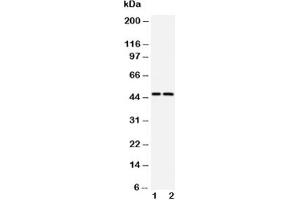 Western blot testing of Caspase-2 antibody and Lane 1:  CEM;  2: SMMC-7721 cell lysate (Caspase 2 Antikörper  (AA 417-439))