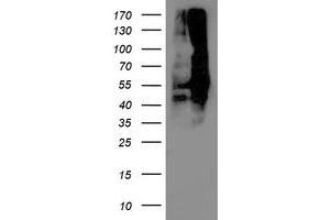 Image no. 1 for anti-Dihydrolipoamide Dehydrogenase (DLD) antibody (ABIN1497849) (DLD Antikörper)