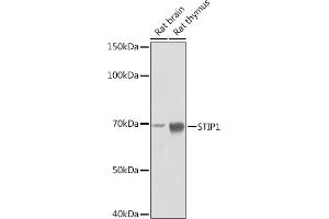 Western blot analysis of extracts of various cell lines, using STIP1 Rabbit mAb (ABIN1512566, ABIN3020619, ABIN3020620 and ABIN7101303) at 1:1000 dilution. (STIP1 Antikörper)