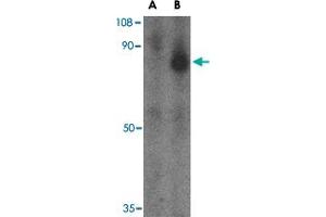 Western blot analysis of FEZ1 in SK-N-SH cell lysate with FEZ1 polyclonal antibody  at 1 ug/mL in the (A) presence and (B) absence of blocking peptide. (FEZ1 Antikörper  (C-Term))