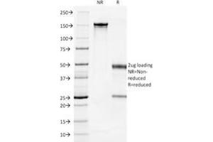 SDS-PAGE Analysis Purified Cytokeratin 7 Mouse Monoclonal Antibody (OV-TL12/30). (Cytokeratin 7 Antikörper)