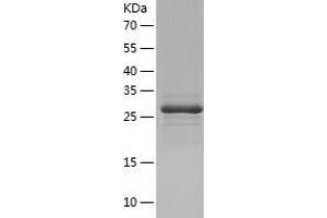 Western Blotting (WB) image for Cerebral Cavernous Malformation 2 (CCM2) (AA 66-353) protein (His tag) (ABIN7122246) (CCM2 Protein (AA 66-353) (His tag))