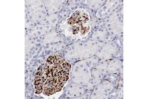 Immunohistochemical staining of human kidney with PRX polyclonal antibody  shows strong cytoplasmic and nuclear positivity in cells in glomeruli at 1:200-1:500 dilution. (Periaxin Antikörper)