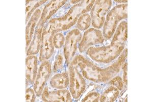 Immunohistochemistry of paraffin-embedded rat kidney using SARA Rabbit mAb (ABIN7271559) at dilution of 1:50 (40x lens). (ZFYVE9 Antikörper)
