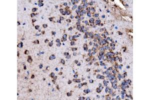 IHC analysis of Glycogen synthase 1/GYS1 using anti-Glycogen synthase 1/GYS1 antibody (ABIN7602155).