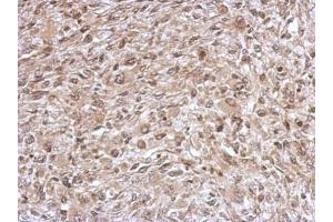 IHC-P Image Immunohistochemical analysis of paraffin-embedded C2C12 xenograft, using TrxR1, antibody at 1:500 dilution. (TXNRD1 Antikörper)