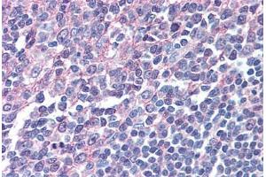 Human Tonsil (Formalin-Fixed Paraffin-Embed) stained with IRF8 antibody ABIN305734 at 5 ug/ml followed by biotinylated anti-goat IgG secondary antibody ABIN481715, alkaline phosphatase-streptavidin and chromogen. (IRF8 Antikörper  (AA 414-426))