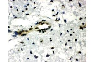 IHC-P: CtBP1 antibody testing of rat brain tissue (CTBP1 Antikörper  (AA 425-440))