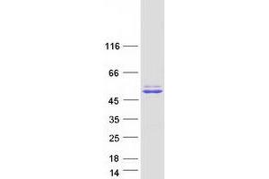 Western Blotting (WB) image for GPN-Loop GTPase 1 (GPN1) (Transcript Variant 1) protein (Myc-DYKDDDDK Tag) (ABIN2722170)