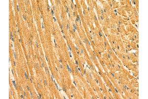 ABIN6264894 and ABIN6266632 at 1/100 staining Rat heart tissue by IHC-P. (S100A1 Antikörper  (N-Term))
