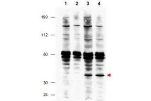 Western blot using FANCF polyclonal antibody  shows detection of FANCF present in a lysate prepared from a Fanconi anemia complementation group F patient lymphoblast after retroviral correction using hFANCF cDNA (lanes 3 and 4).