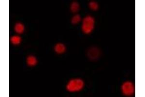 ABIN6274302 staining LOVO cells by IF/ICC. (IRX1 Antikörper  (Internal Region))