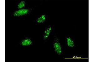 Immunofluorescence of monoclonal antibody to HAND2 on HeLa cell. (HAND2 Antikörper  (AA 135-216))