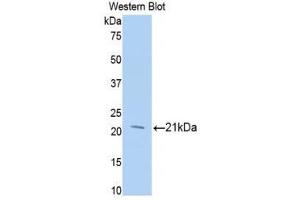 Western Blotting (WB) image for anti-Meningioma Expressed Antigen 5 (Hyaluronidase) (MGEA5) (AA 271-438) antibody (ABIN1859958) (MGEA5 Antikörper  (AA 271-438))