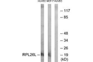 Western blot analysis of extracts from HuvEc/MCF-7 cells, using RPL26L Antibody. (RPL26L Antikörper  (AA 96-145))