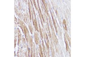 Immunohistochemistry of paraffin-embedded mouse heart using NPPA Rabbit pAb (ABIN7268829) at dilution of 1:100 (40x lens). (NPPA Antikörper  (AA 26-151))