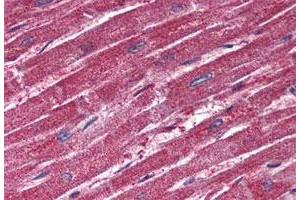 Immunohistochemistry (Formalin/PFA-fixed paraffin-embedded sections) of human heart tissue with TRPM4 polyclonal antibody . (TRPM4 Antikörper  (N-Term))