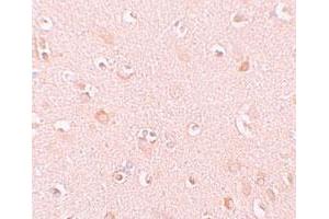Immunohistochemical staining of human brain cells with NLRP5 polyclonal antibody  at 10 ug/mL. (NLRP5 Antikörper  (C-Term))