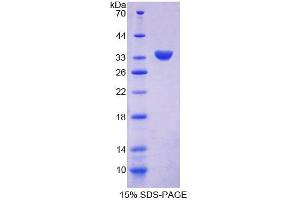 SDS-PAGE analysis of Human CHN2 Protein. (CHN2 Protein)