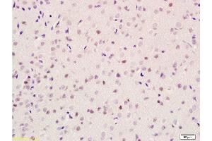 Formalin-fixed and paraffin embedded rat brain tissue labeled with Anti-GIG8/ID2 Polyclonal Antibody, Unconjugated  at 1:100 followed by conjugation to the secondary antibody and DAB staining