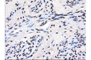 Immunohistochemical staining of paraffin-embedded Ovary tissue using anti-GBE1mouse monoclonal antibody. (GBE1 Antikörper)