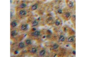Used in DAB staining on fromalin fixed paraffin-embedded Liver tissue (TFPI Antikörper  (AA 29-210))