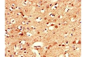 Immunohistochemistry of paraffin-embedded human brain tissue using ABIN7146589 at dilution of 1:100