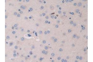 Immunohistochemistry (IHC) image for anti-Heparanase (HPSE) (AA 353-464) antibody (ABIN7438439)