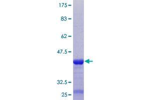 Image no. 1 for ABI Family, Member 3 (NESH) Binding Protein (ABI3BP) (AA 511-609) protein (GST tag) (ABIN1305533) (ABI3BP Protein (AA 511-609) (GST tag))
