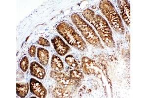 Immunohistochemistry (IHC) image for anti-Valosin Containing Protein (VCP) (C-Term) antibody (ABIN3029567)