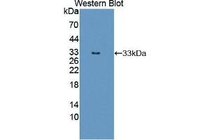 Western blot analysis of the recombinant protein. (ERBB3 Antikörper  (AA 709-966))