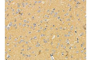 Nestin Mouse Monoclonal Antibody at 1/100 staining rat brain tissue by IHC-P. (Nestin Antikörper  (C-Term))