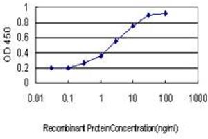 Detection limit for recombinant GST tagged SERPINB3 is approximately 0. (SERPINB3 Antikörper  (AA 276-390))