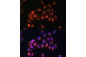 Immunofluorescence analysis of HeLa cells using BDKRB2 Rabbit pAb (ABIN3016822, ABIN3016823, ABIN3016824 and ABIN6219849) at dilution of 1:100. (BDKRB2 Antikörper  (AA 302-391))