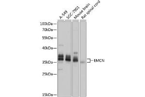 Western blot analysis of extracts of various cell lines, using EMCN antibody (ABIN6127867, ABIN6140148, ABIN6140150 and ABIN6218389) at 1:1000 dilution. (Endomucin Antikörper  (AA 19-135))