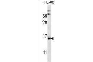 Western Blotting (WB) image for anti-NADH Dehydrogenase (Ubiquinone) 1 alpha Subcomplex, Assembly Factor 4 (NDUFAF4) antibody (ABIN2997063) (NDUFAF4 Antikörper)