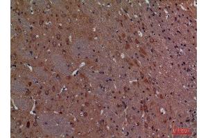 Immunohistochemistry (IHC) analysis of paraffin-embedded Rat Brain, antibody was diluted at 1:100. (CALB1 Antikörper  (C-Term))