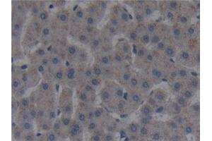 Detection of FAPa in Human Liver Tissue using Polyclonal Antibody to Fibroblast Activation Protein Alpha (FAPa) (FAP Antikörper  (AA 523-760))