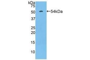 Detection of Recombinant FcgR3A, Rat using Polyclonal Antibody to Fc Fragment Of IgG Low Affinity IIIa Receptor (FcgR3A) (FCGR3A Antikörper  (AA 5-241))