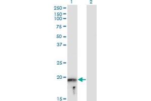 Western Blot analysis of MYLPF expression in transfected 293T cell line by MYLPF monoclonal antibody (M05), clone 3H3. (MYLPF Antikörper  (AA 1-169))