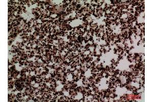 Immunohistochemistry (IHC) image for anti-Forkhead Box P1 (FOXP1) (C-Term) antibody (ABIN3187748)