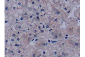 Detection of VEGF165 in Human Liver Tissue using Monoclonal Antibody to Vascular Endothelial Growth Factor 165 (VEGF165) (VEGF 165 (AA 28-191) Antikörper)