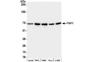 anti-Paraspeckle Component 1 (PSPC1) (AA 425-475) antibody