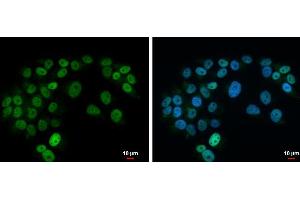 ICC/IF Image Islet 1 antibody detects Islet 1 protein at nucleus by immunofluorescent analysis. (ISL1 Antikörper)